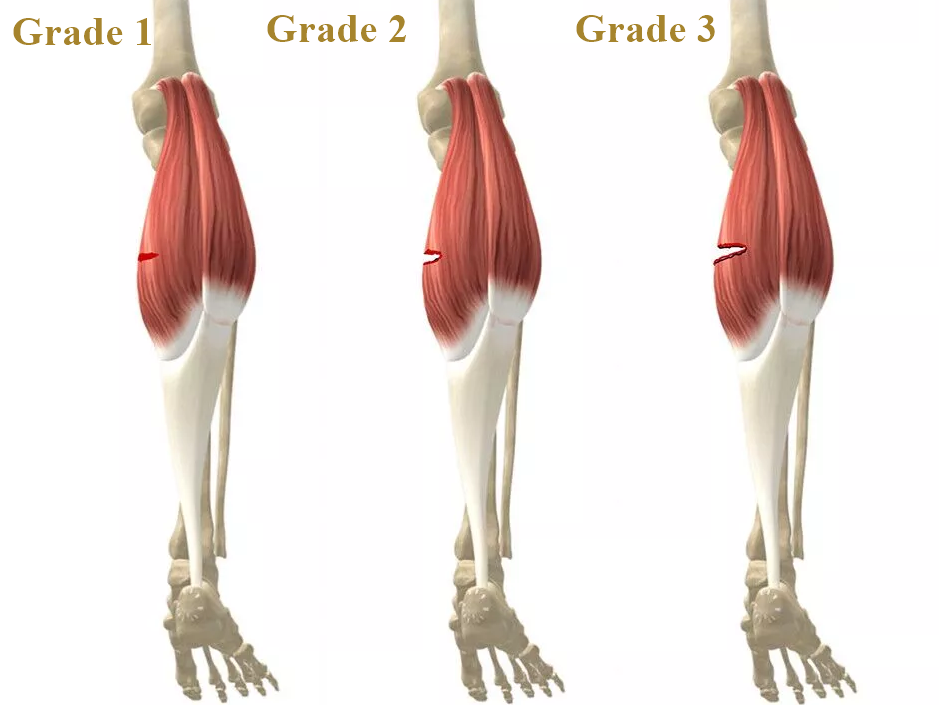 grade1-3.png
