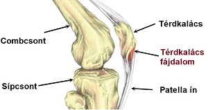 patella-in-gyulladas.jpg