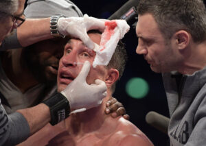 cutman1-1-300x213.jpg